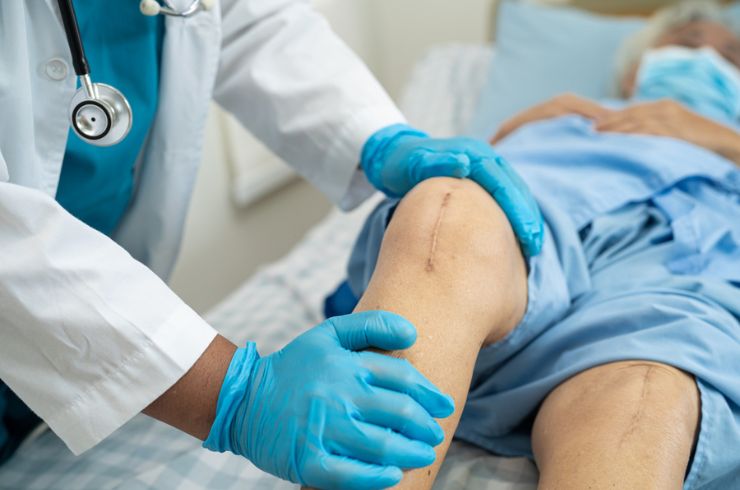 knee joint replacement